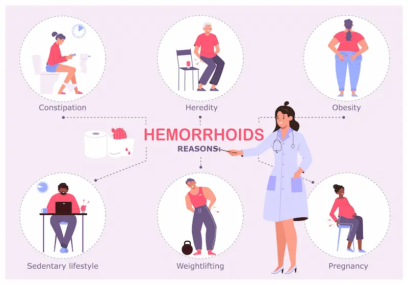 síntomas de hemorroides trombosadas